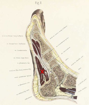 section through the adult human right foot (Braune, 1867)